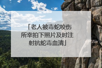 老人被毒蛇咬伤 所幸拍下照片及时注射抗蛇毒血清